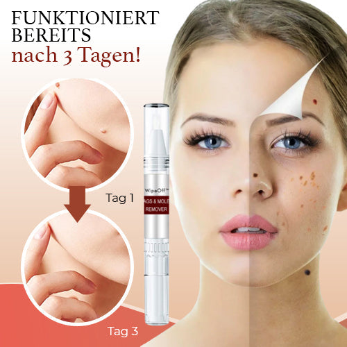 WipeOff™ Tags & Maulwurfsentferner (1+1 Gratis)