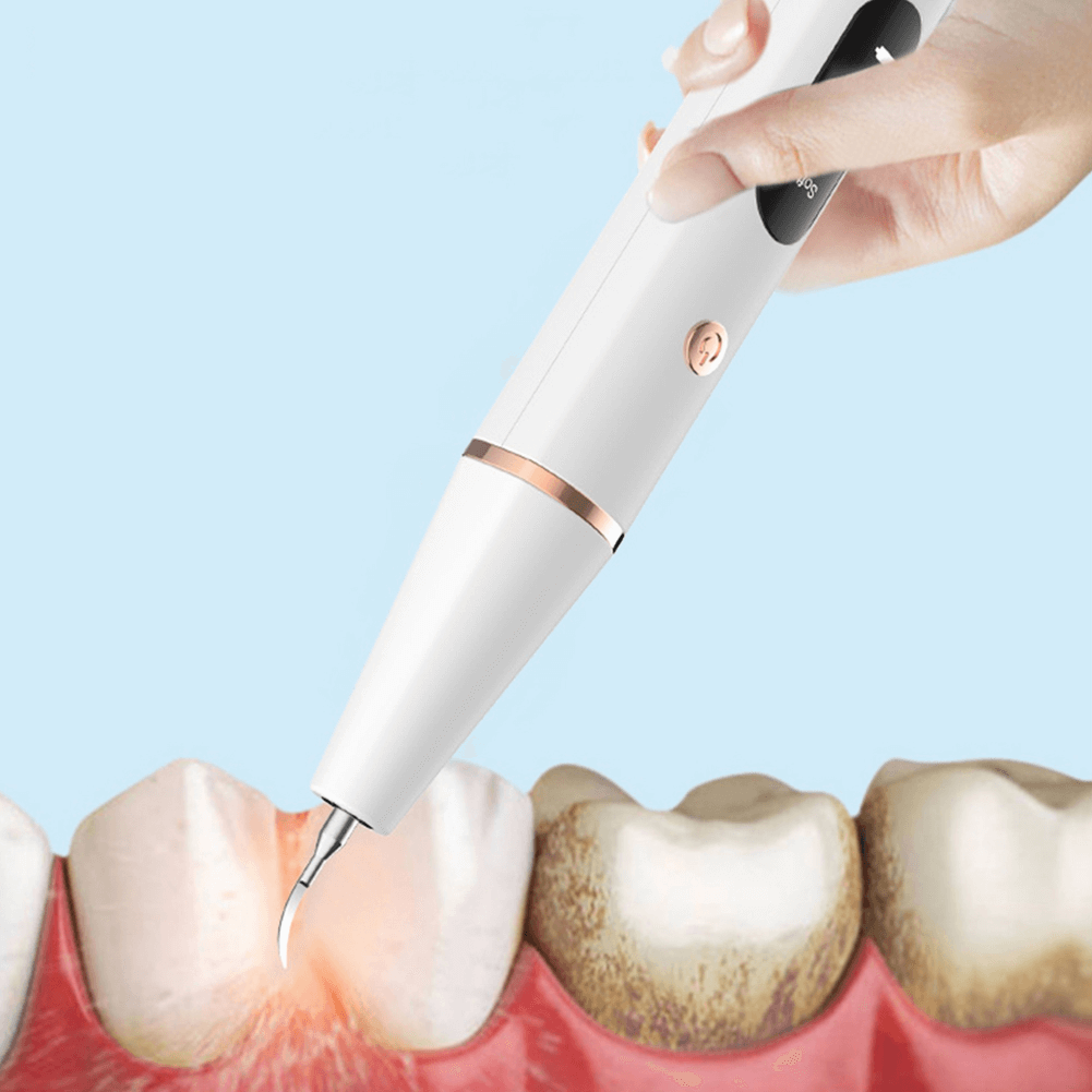 DentalScaler - Verabschiede dich von Plaque und Karies